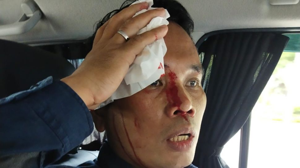 Kasat Intel Polres Jakpus Berdarah-darah Dipukul Pendemo Tolak DOB Papua, KSP: Nodai Tujuan Aksi Demonstrasi